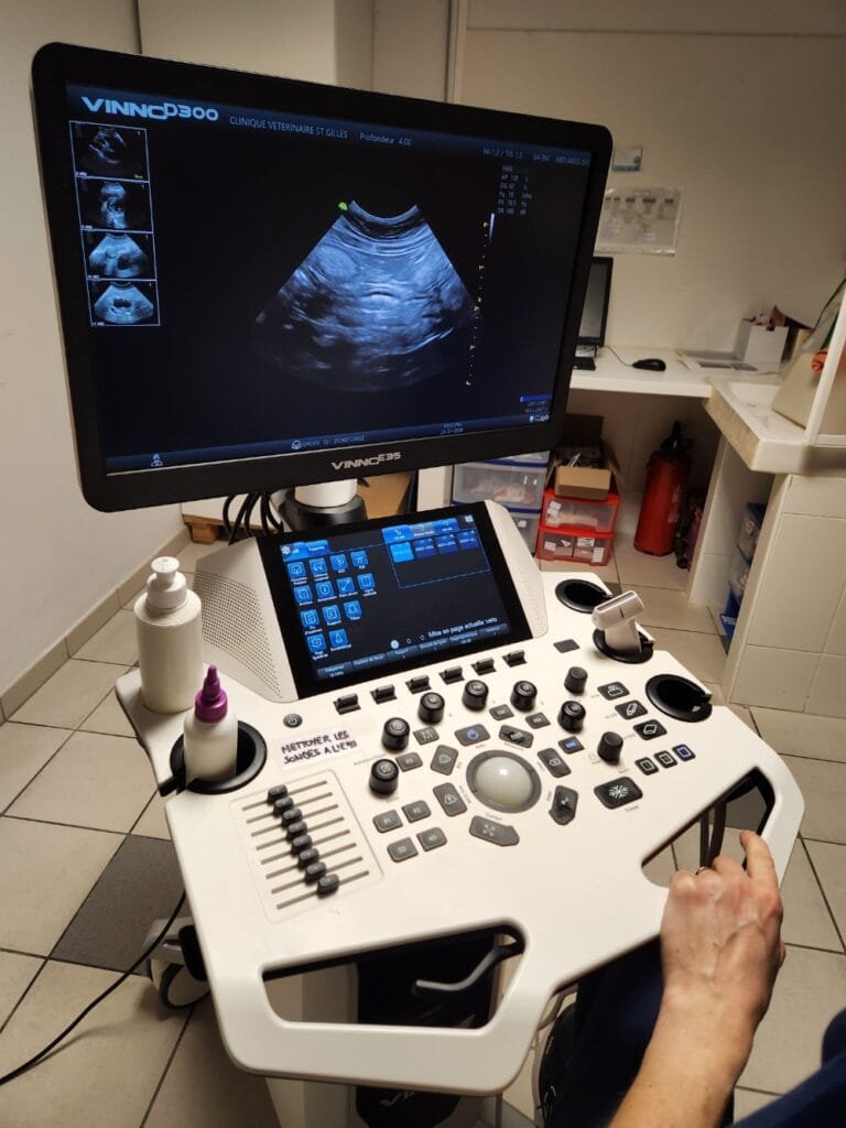 Appareil d’échographie